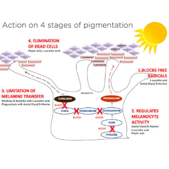 Présentation du mélasma et d'autres hyperpigmentations à l'aide de TCA PEEL avec le système modérateur